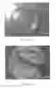 Fig. 02 - System and method for forming skeletal muscle constructs having functional tissue interfaces