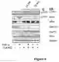 Fig. 07 - Methods of detecting chronic lymphocytic leukemia with Hsp90 and ZAP-70