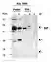 Fig. 01 - Lactoferrin cleavage of neisserial proteins