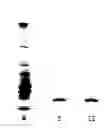 Fig. 01 - Bacillus Subtilis Strain and its Use in Preparing Pharmaceuticals for Treating Thrombosis