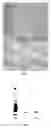 Fig. 03 - Bacillus Subtilis Strain and its Use in Preparing Pharmaceuticals for Treating Thrombosis