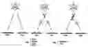 Fig. 01 - Isolation and use of solid tumor stem cells