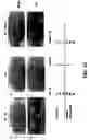 Fig. 18 - Isolation and use of solid tumor stem cells