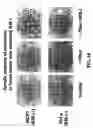 Fig. 24 - Isolation and use of solid tumor stem cells