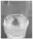 Fig. 01 - COMMERCIALLY VIABLE PROCESS FOR IN VITRO MASS CULTURE OF JATROPHA CURCAS