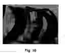 Fig. 11 - Alterations utilizing nanoparticles