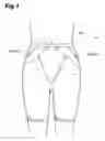 Fig. 02 - Bottom clothes
