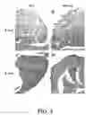 Fig. 04 - Use of Fgf-18 Protein, Target Proteins and Their Respective Encoding Nucleotide Sequences to Induce Cartilage Formation