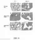 Fig. 05 - Use of Fgf-18 Protein, Target Proteins and Their Respective Encoding Nucleotide Sequences to Induce Cartilage Formation