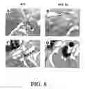Fig. 09 - Use of Fgf-18 Protein, Target Proteins and Their Respective Encoding Nucleotide Sequences to Induce Cartilage Formation