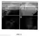 Fig. 10 - Use of Fgf-18 Protein, Target Proteins and Their Respective Encoding Nucleotide Sequences to Induce Cartilage Formation