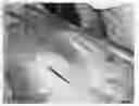 Fig. 01 - Wound healing agent and composition