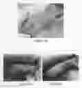Fig. 03 - Wound healing agent and composition