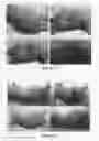Fig. 04 - Wound healing agent and composition