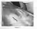 Fig. 05 - Wound healing agent and composition