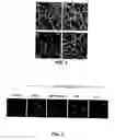 Fig. 03 - Methods and compositions to treat mucositis