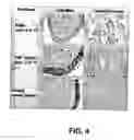 Fig. 04 - Methods and compositions to treat mucositis