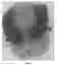 Fig. 04 - Synergistic pharmaceutical composition for serotonin reuptake inhibition and process of preparation thereof
