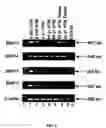 Fig. 18 - Method for treating glaucoma comprising administering to a patient in need thereof a composition comprising an antibody against gremlin