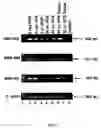 Fig. 19 - Method for treating glaucoma comprising administering to a patient in need thereof a composition comprising an antibody against gremlin