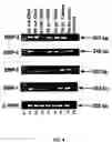 Fig. 20 - Method for treating glaucoma comprising administering to a patient in need thereof a composition comprising an antibody against gremlin