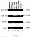 Fig. 22 - Method for treating glaucoma comprising administering to a patient in need thereof a composition comprising an antibody against gremlin