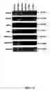 Fig. 24 - Method for treating glaucoma comprising administering to a patient in need thereof a composition comprising an antibody against gremlin