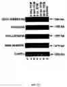 Fig. 25 - Method for treating glaucoma comprising administering to a patient in need thereof a composition comprising an antibody against gremlin