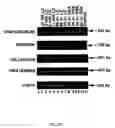 Fig. 26 - Method for treating glaucoma comprising administering to a patient in need thereof a composition comprising an antibody against gremlin