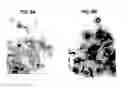 Fig. 06 - Method for treating atherosclerosis or restenosis using microtubule stabilizing agent