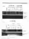 Fig. 09 - Polymorphs of suberoylanilide hydroxamic acid