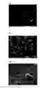 Fig. 02 - Bioactive bone cement and method for the production thereof