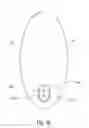 Fig. 12 - Electronically Controlled Ingestible Capsule for Sampling Fluids in Alimentary Tract