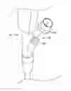 Fig. 01 - Endoscope cap
