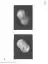 Fig. 05 - SYSTEM, DEVICE, AND METHOD FOR DERMAL IMAGING