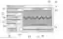 Fig. 01 - Small Animal Pulse Oximeter User Interface