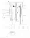 Fig. 01 - Minimally Invasive Surgical Appartus and Methods