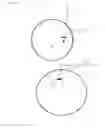 Fig. 03 - Minimally Invasive Surgical Appartus and Methods
