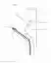 Fig. 04 - Minimally Invasive Surgical Appartus and Methods