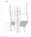 Fig. 05 - Minimally Invasive Surgical Appartus and Methods