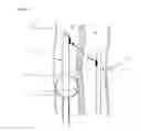 Fig. 07 - Minimally Invasive Surgical Appartus and Methods