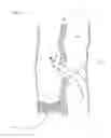 Fig. 08 - Minimally Invasive Surgical Appartus and Methods