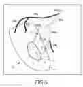Fig. 05 - Apparatus and method for determining an injection point for targeted drug