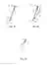 Fig. 02 - Apparatus and method for aligning a light pointer with a medical interventional device trajectory