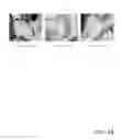 Fig. 35 - Virtual colonoscopy via wavelets