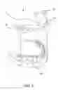 Fig. 09 - Surgical Positioning Device
