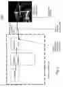 Fig. 03 - ULTRASOUND IMAGING REMOTE CONTROL UNIT