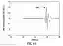 Fig. 08 - Ultrasonic bone assessment apparatus and method
