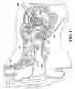 Fig. 02 - Implantable Microphone Noise Suppression
