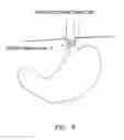 Fig. 06 - Methods and apparatus for testing disruption of a vagal nerve
